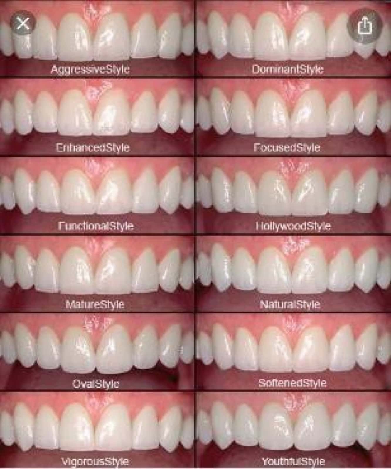 Full-mouth rehabilitation — planning
